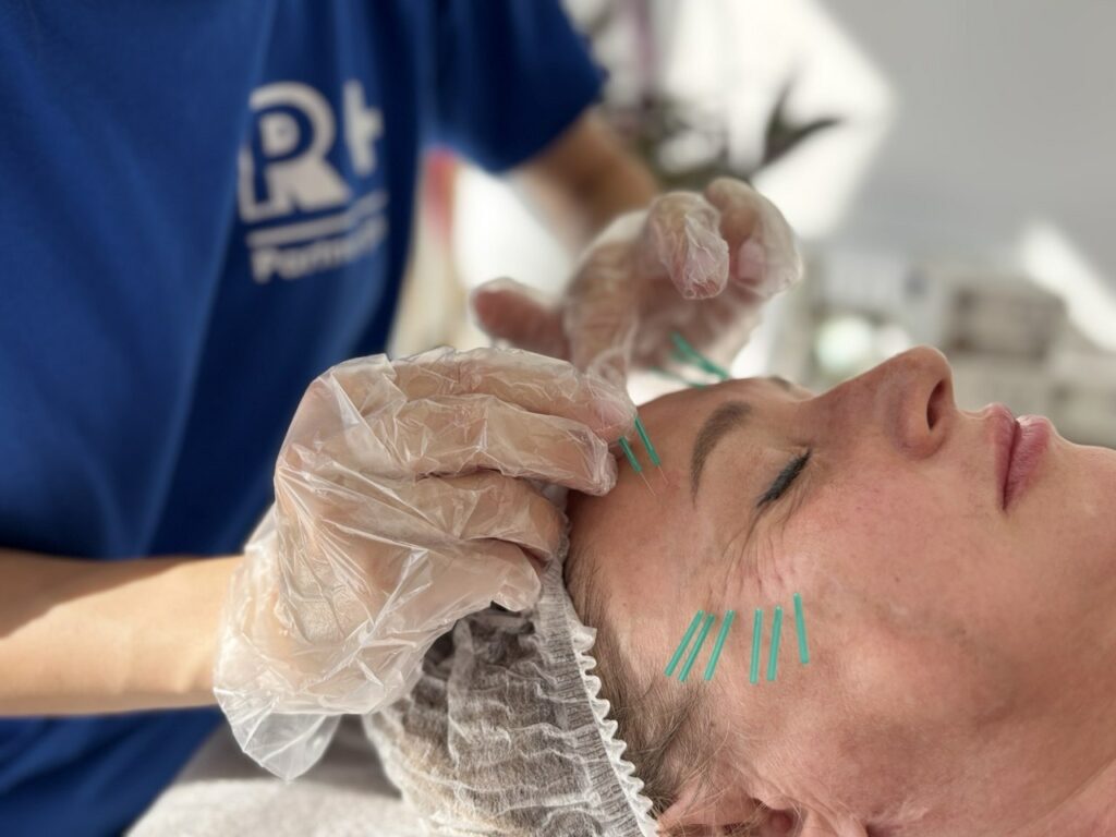 Тренінг з оволодіння практичними навичками "Акупунктурний ліфтинг методом сухої голки" (16 балів БПР) photo 2025 12 24 11 22 05 1